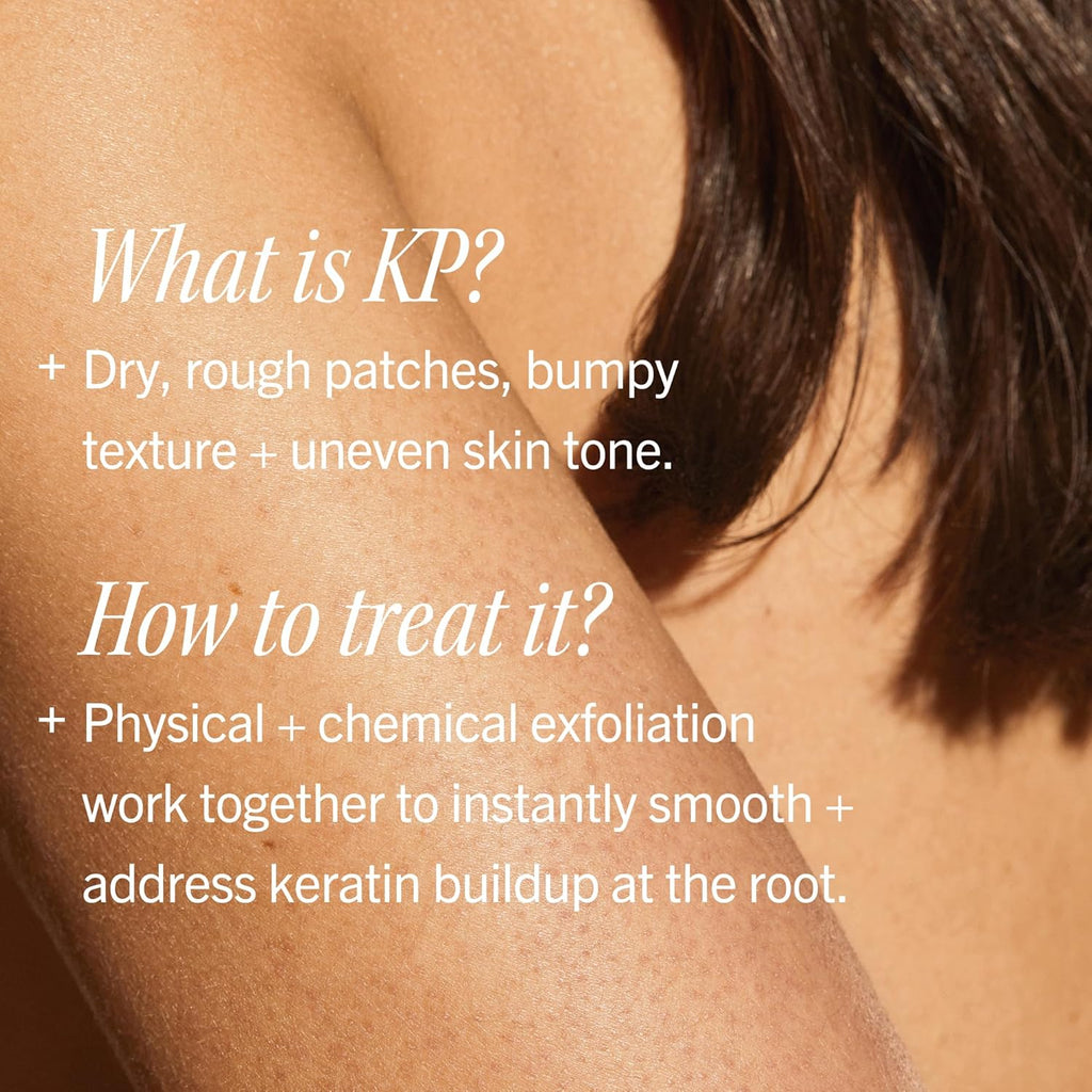 First Aid Beauty KP Bump Eraser Body Scrub with 10% AHA - Dermatologist-Tested Keratosis Pilaris Exfoliator - Support for Rough Bumps, Uneven Skin Texture & Strawberry Skin - Sensitive Skin